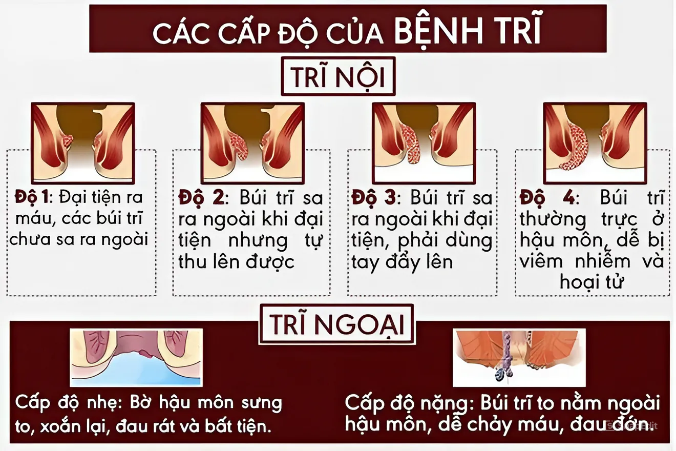 phau-thuat-cat-tri