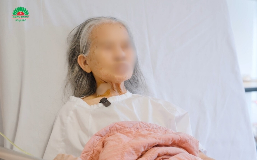 phau-thuat-noi-soi-cat-tui-mat