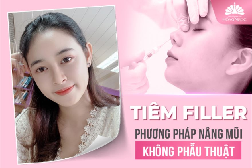 phẫu thuật nâng mũi