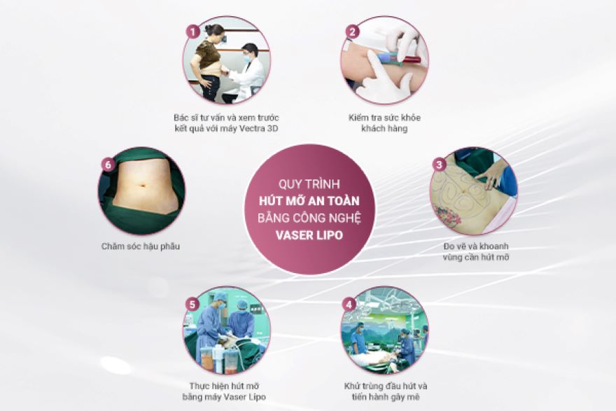 hút mỡ Vaser Lipo