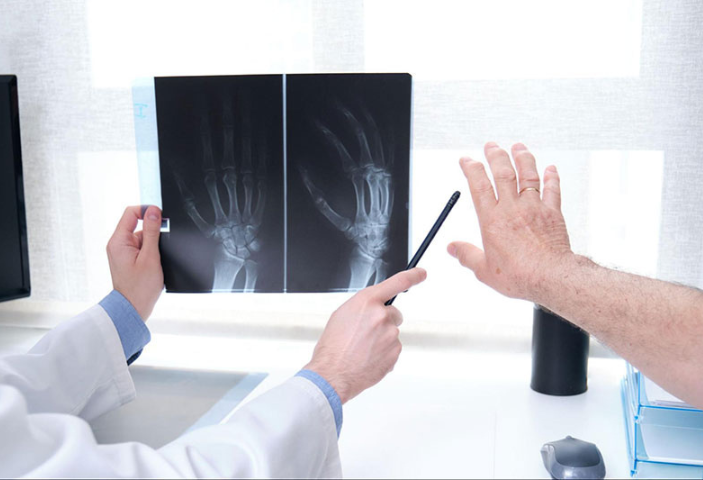 Viêm khớp vi tinh thể