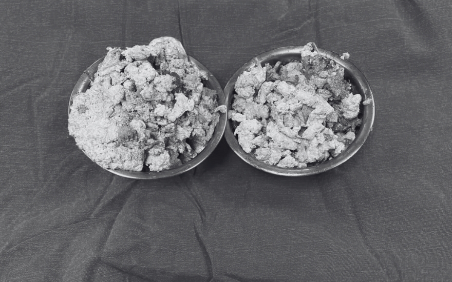 Thay Khop Goi Bn Nam (1)