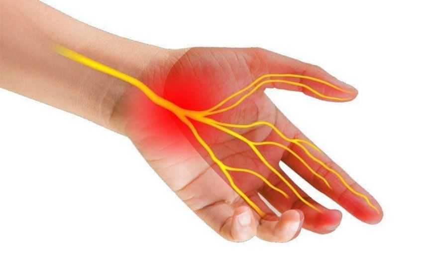 Tổn thương thần kinh giữa