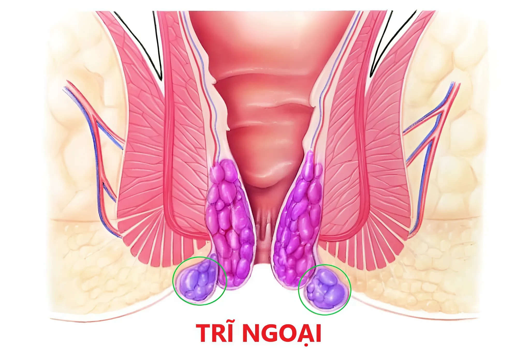 cac-giai-doan-benh-tri