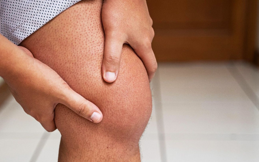 viêm khớp phản ứng