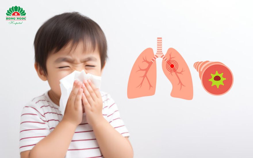 Viem Phe Quan Cap O Tre Em