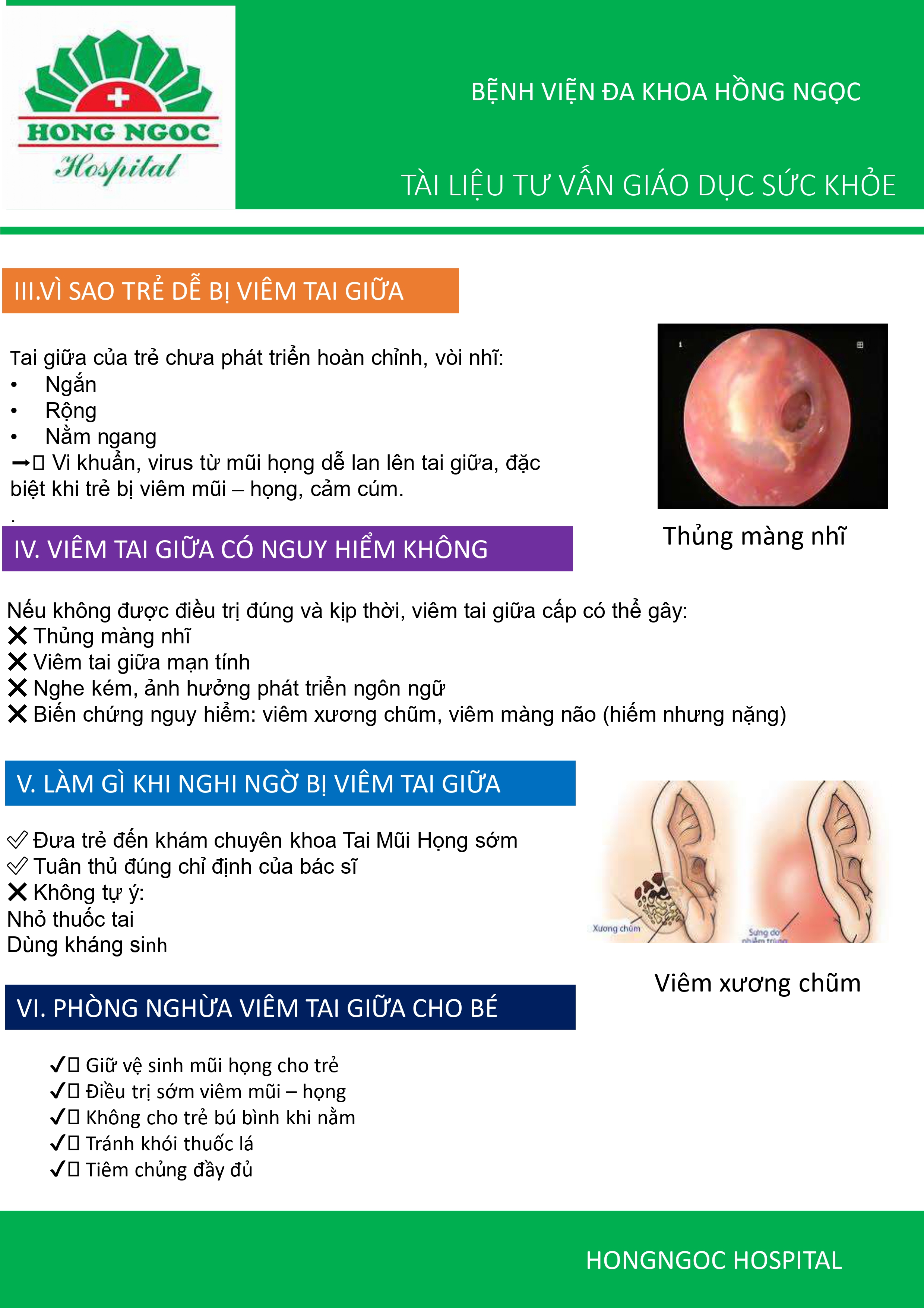 Viem Tai Giua Cap Tre Em Gdsk 1