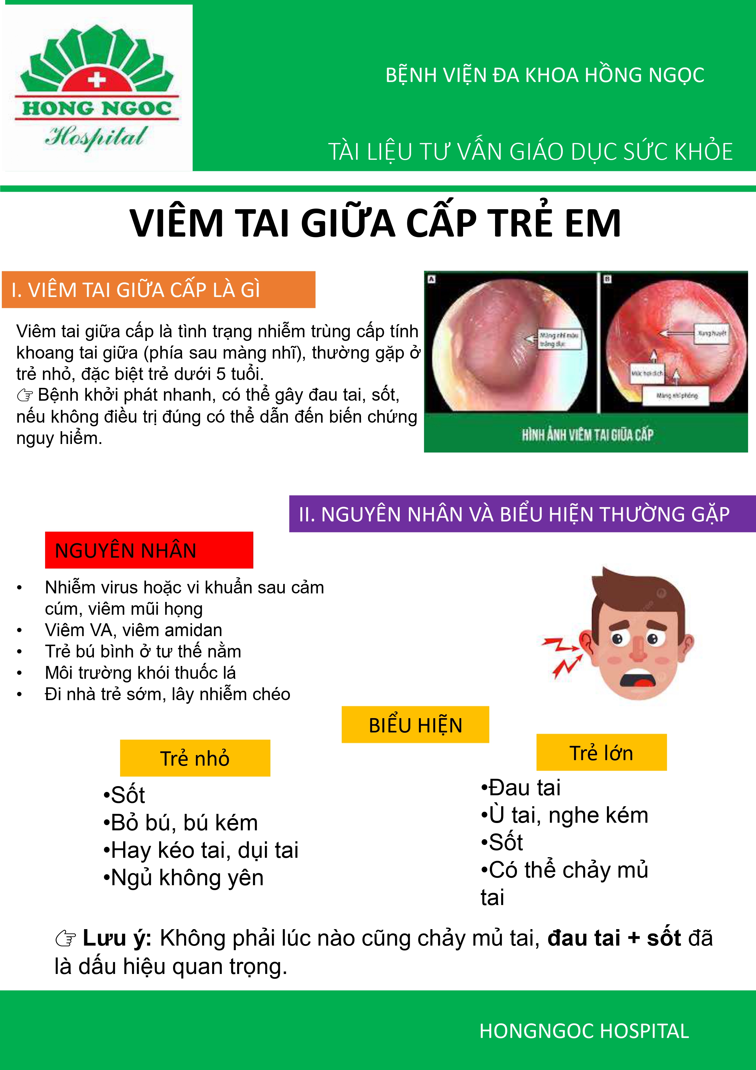 Viem Tai Giua Cap Tre Em Gdsk 1