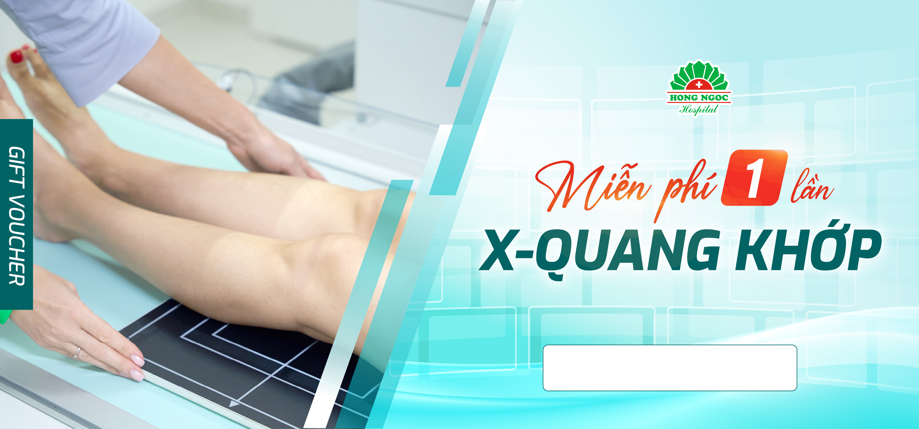 Voucher Ofline X Quang Khop 500 Cái 01