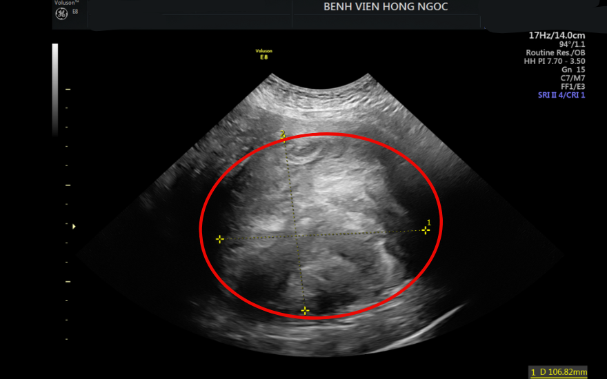 Vung Kin Co Mui Hoi (10)