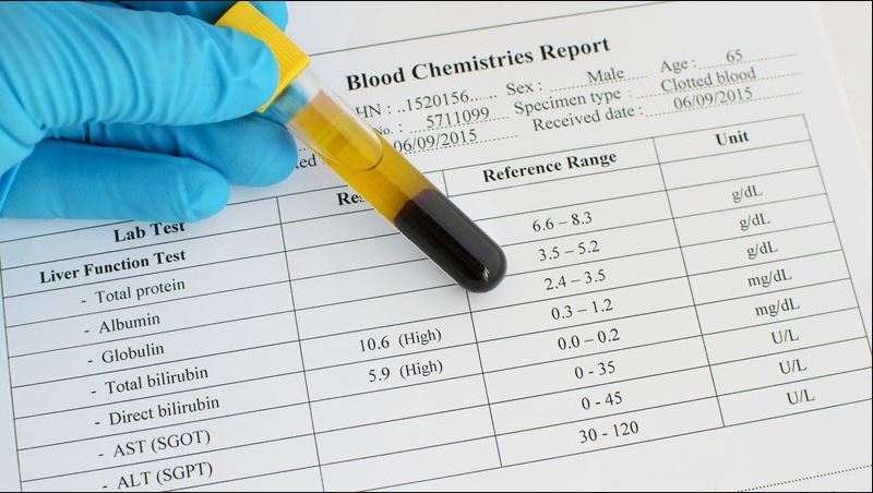 Lưu ý khi thực hiện xét nghiệm chức năng gan thận