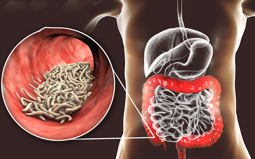 Điều trị bệnh kiết lỵ