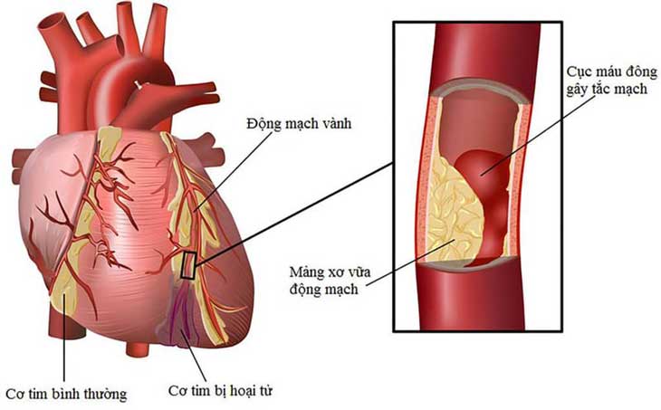 Sữa và chế phẩm từ sữa nguyên kem