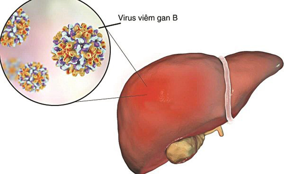 4. Cách xử lý khi mẹ bầu bị viêm gan B