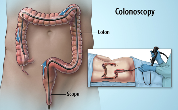 Phương pháp chăm sóc sau khi nội soi