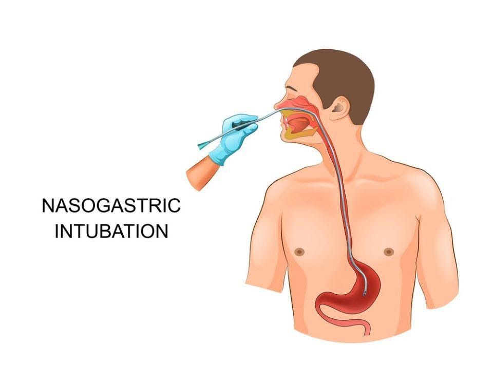 6. Các biến chứng có thể gặp và cách xử lý