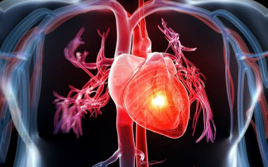 Biến chứng mỡ máu ở người tiểu đường