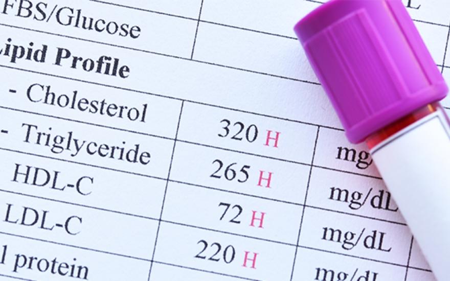 Các chỉ số mỡ máu chính gồm: Cholesterol toàn phần, HDL, LDL và Triglyceride