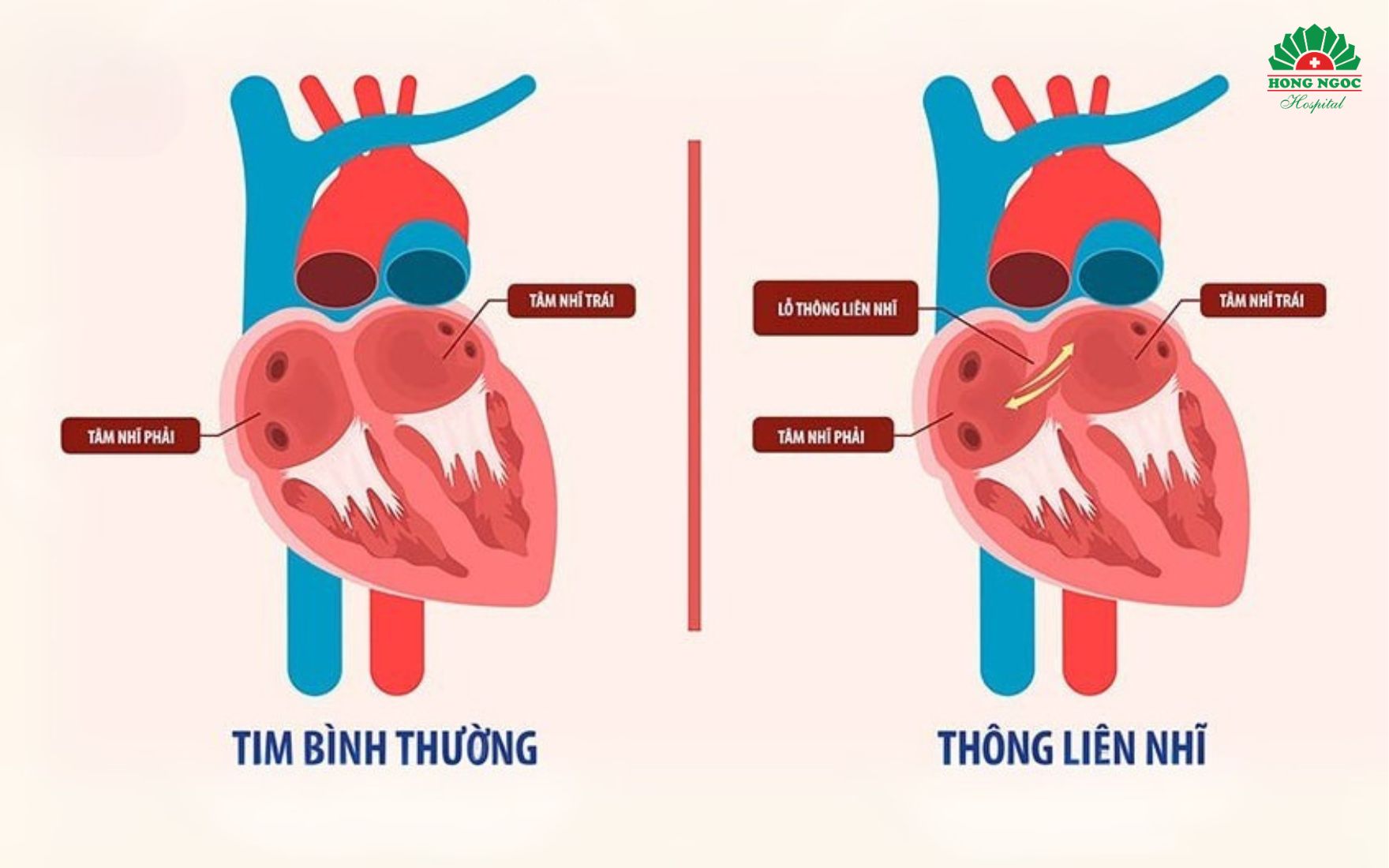 thong-lien-nhi.jpg