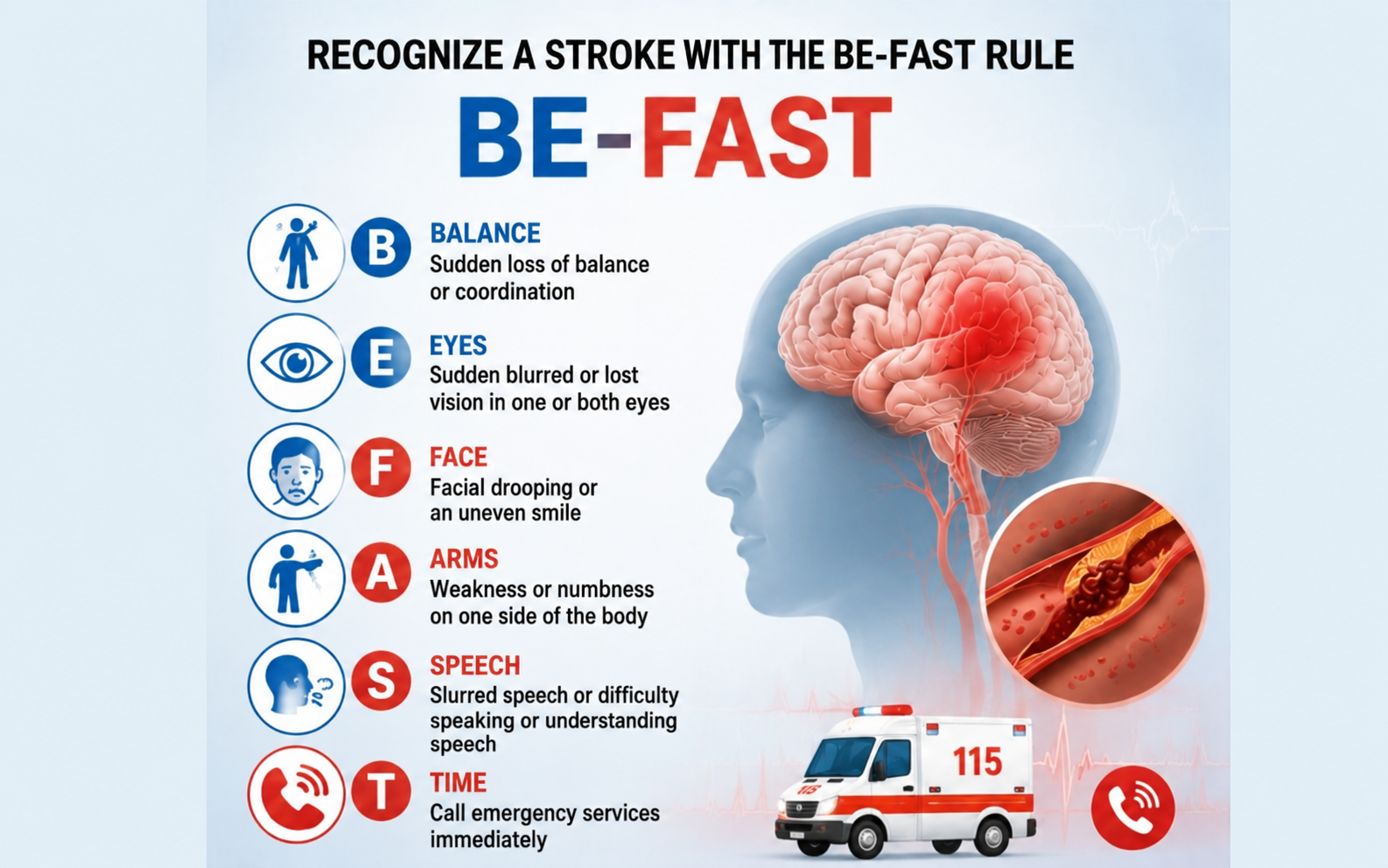 The BE-FAST rule for recognizing stroke.