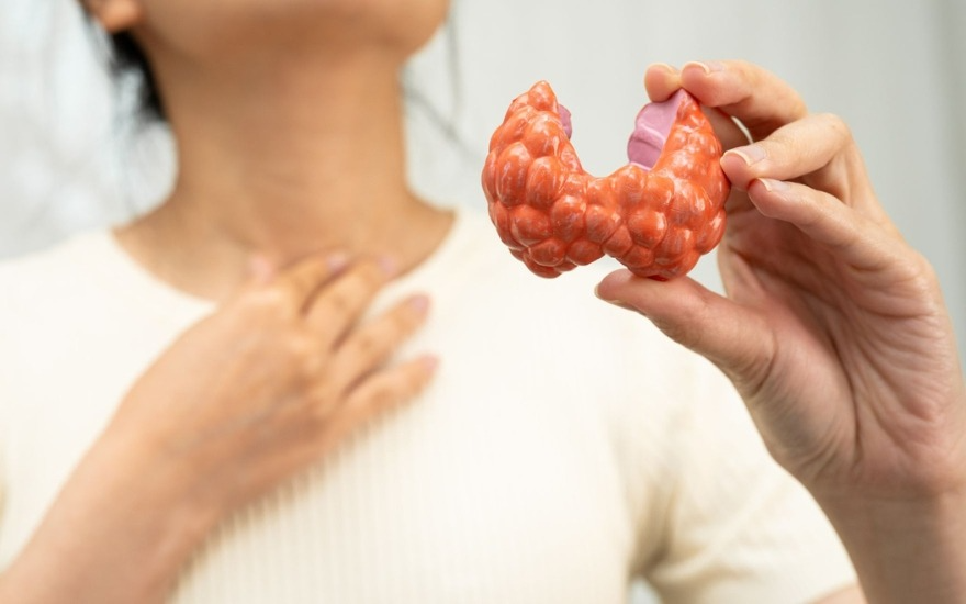 Basedow (Graves' disease) là nguyên nhân phổ biến nhất gây cường giáp