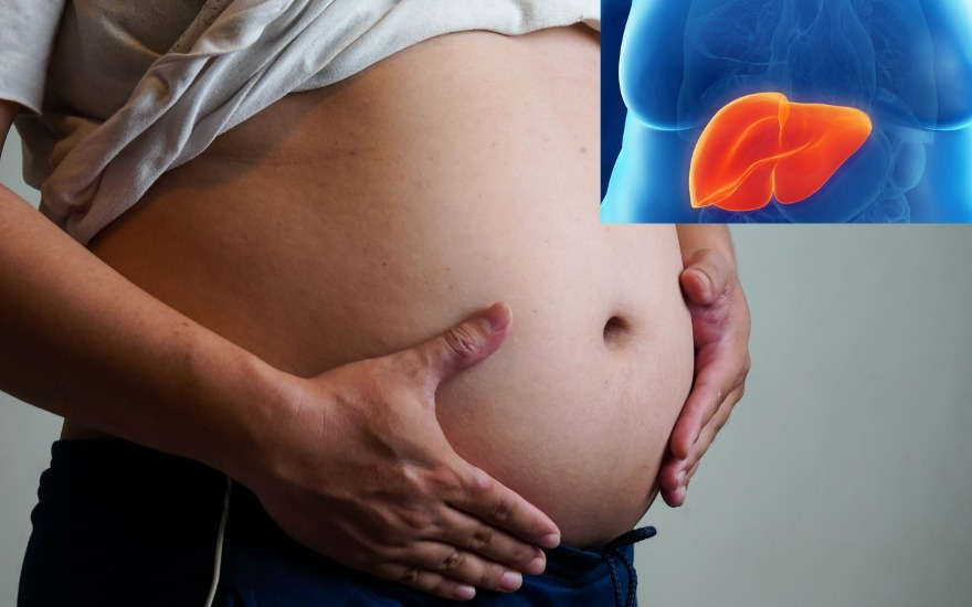Ngưng thở khi ngủ khiến các bệnh lý đi kèm béo phì khó kiểm soát