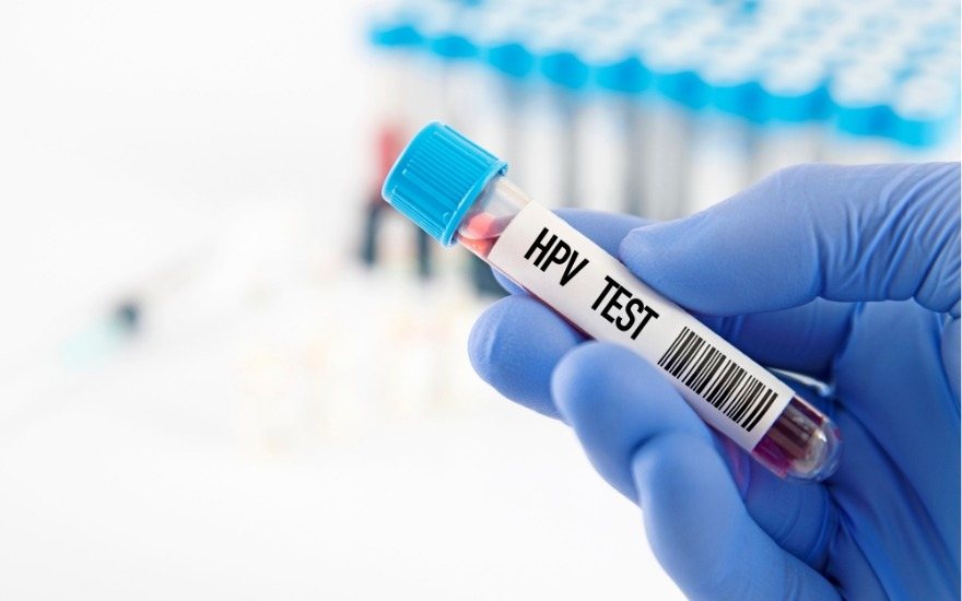 Xét nghiệm HPV có độ nhạy cao trong phát hiện nguy cơ nhiễm HPV nguy cơ cao