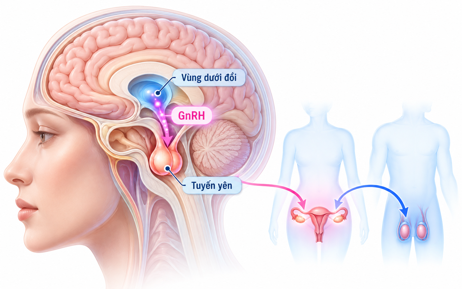 Hormone giải phóng gonadotropin (GnRH) có thể ức chế tạm thời quá trình dậy thì