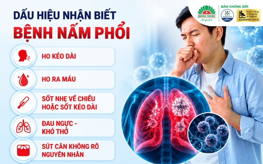 Ở giai đoạn đầu, triệu chứng bệnh nấm phổi rất dễ nhầm lẫn với các bệnh lý hô hấp khác