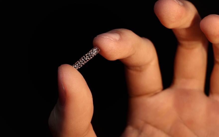 Đặt stent mạch vành giúp tái thông dòng máu, không loại bỏ hoàn toàn nguy cơ