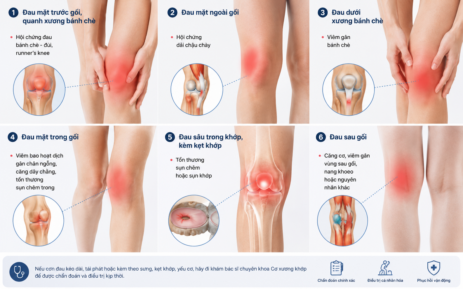 Bảng gợi ý nguyên nhân bệnh theo vị trí đau khớp gối khi chạy bộ