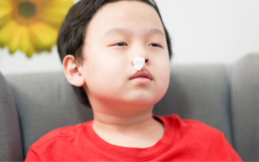 Chảy máu cam ở trẻ sốt xuất huyết