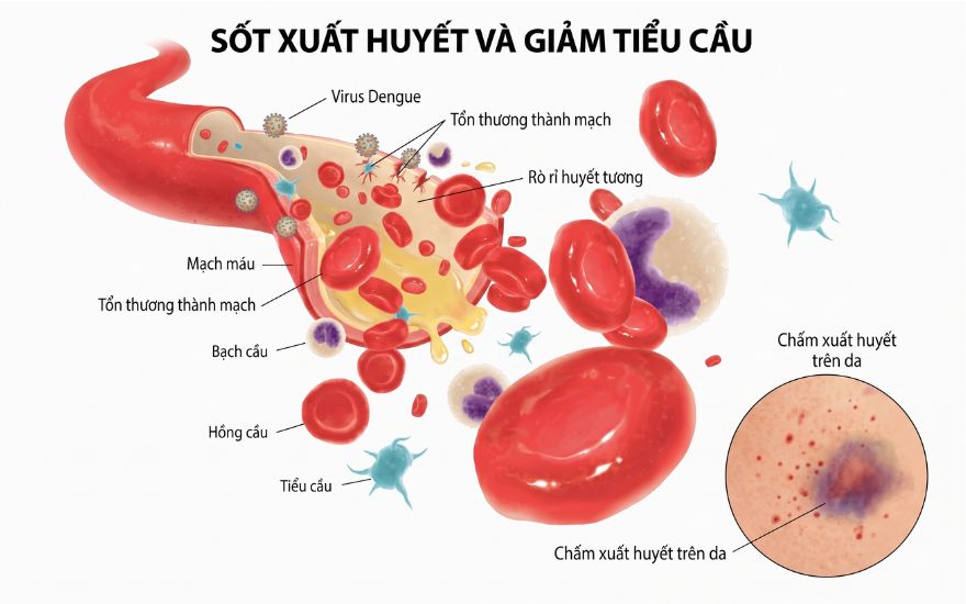 tieu-cau-thuong-giam-quanh-luc-ha-sot-va-tang-khi-hoi-phuc.jpg tieu-cau-thuong-giam-quanh-luc-ha-sot-va-tang-khi-hoi-phuc.jpg