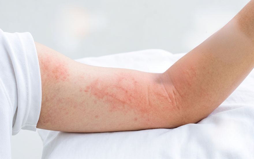 virus-dengue-co-the-lam-giam-tao-va-tang-tieu-thu-tieu-cau.jpg virus-dengue-co-the-lam-giam-tao-va-tang-tieu-thu-tieu-cau.jpg