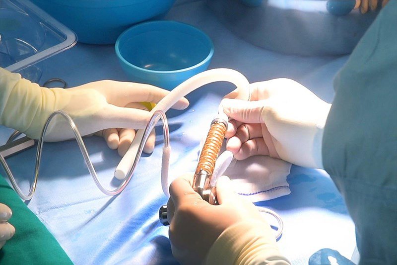 Khi các phương pháp điều trị khác không hiệu quả bệnh nhân sẽ được chỉ định ghép tim