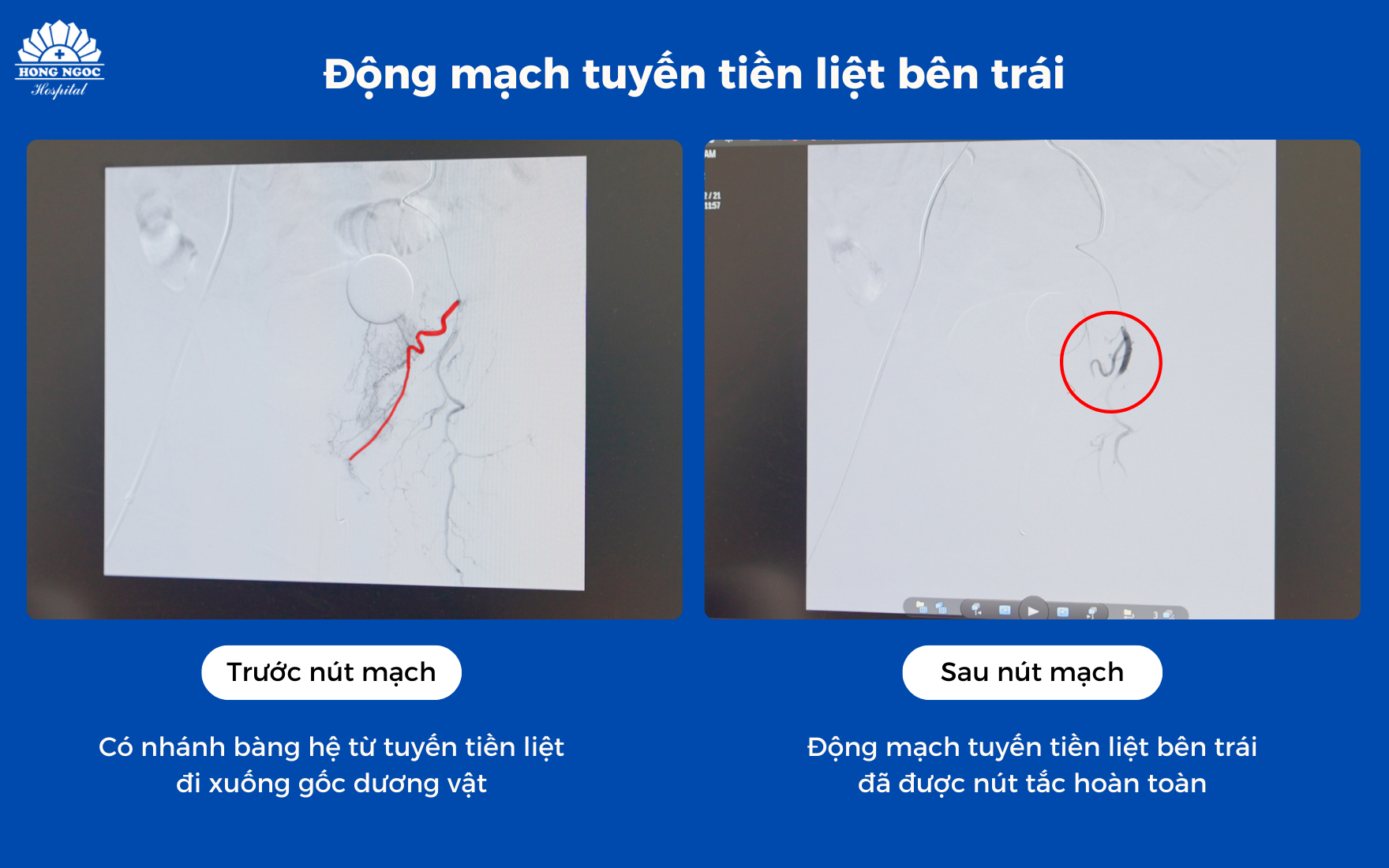 Ảnh Website 880 X 550 (1760 X 1100) (24)