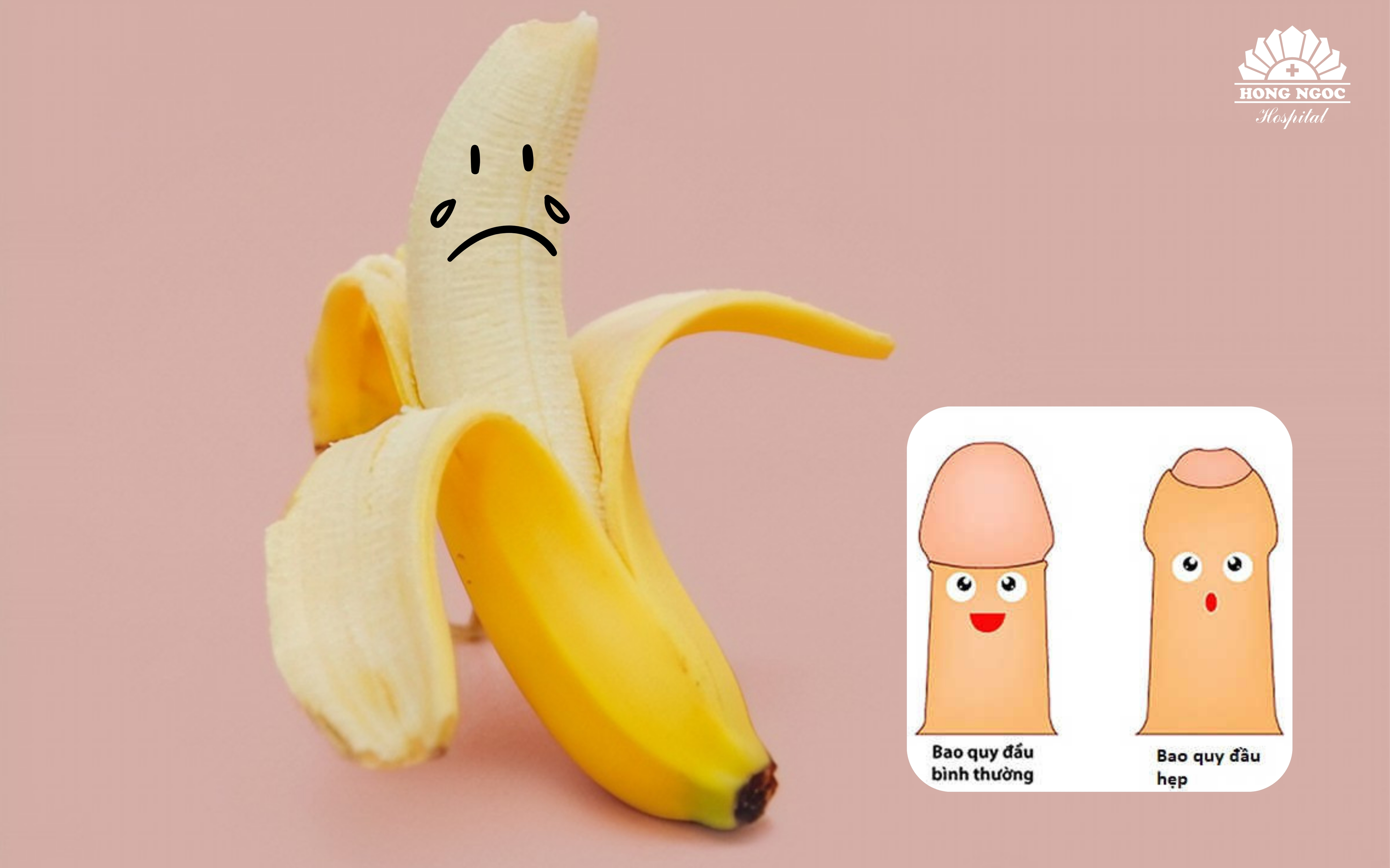 Proper attention and timely management of phimosis play a crucial role in preventing complications and ensuring the long-term health and well-being of the child.