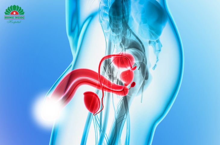 viêm tuyến tiền liệt mãn tính tăng nguy cơ biến chứng