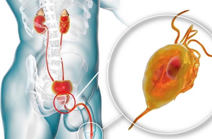 Viem Tuyen Tien Liet Ok