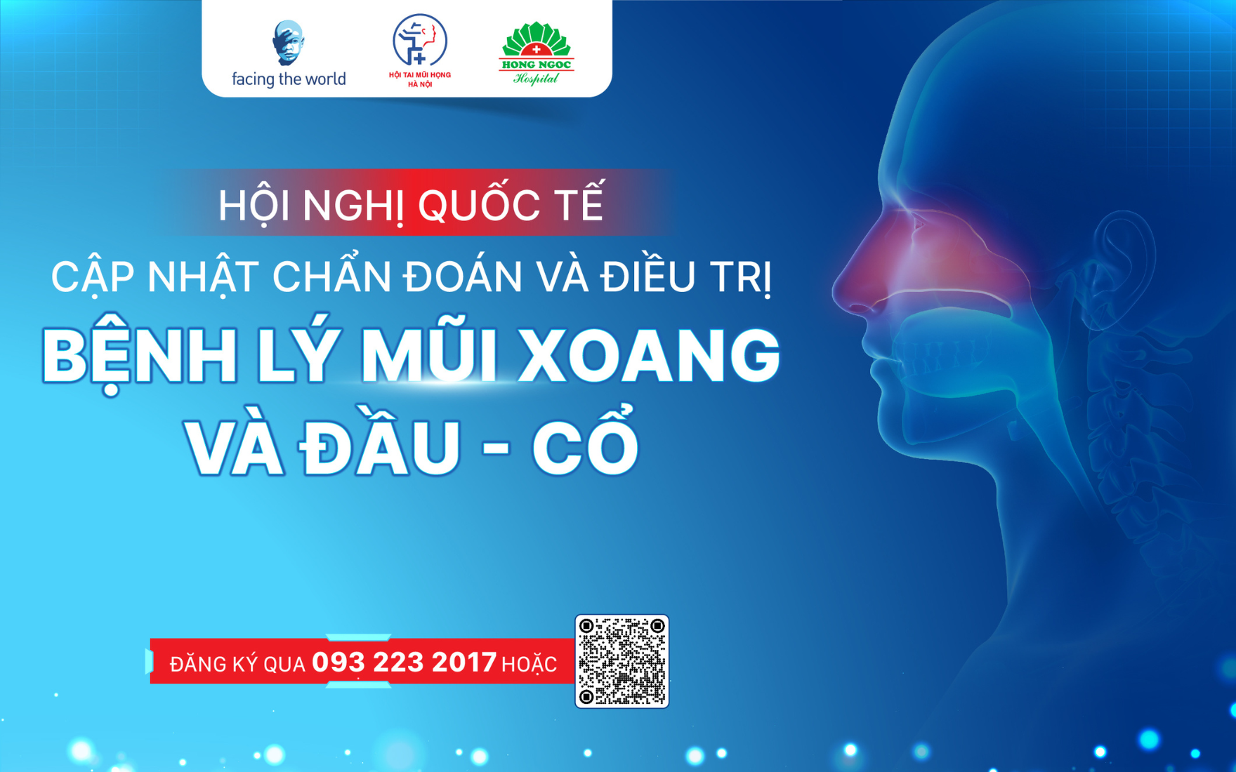 Anh Chinh 