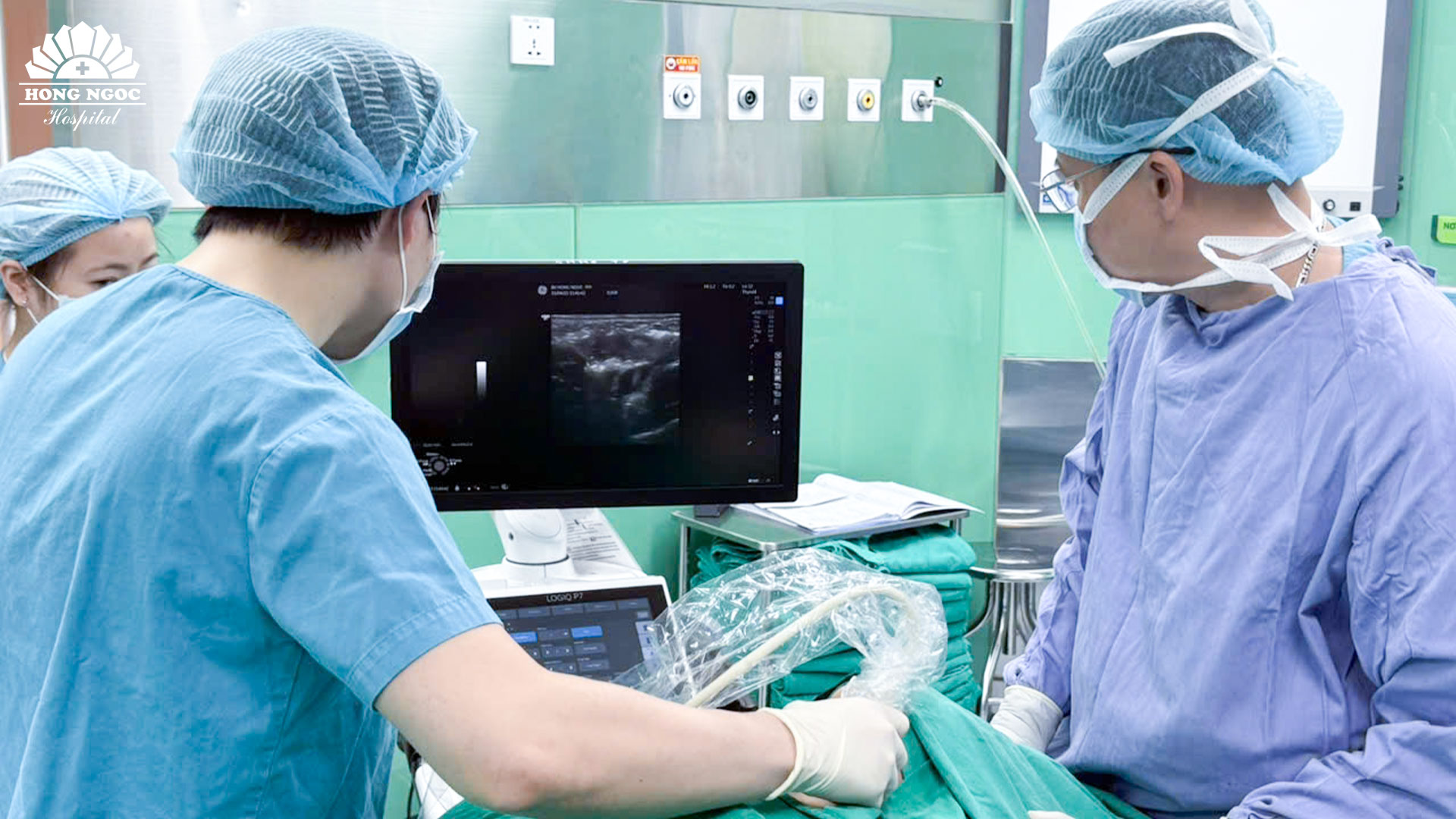 Áp dụng siêu âm tức thì trong mổ định vị chính xác vị trí hạch 