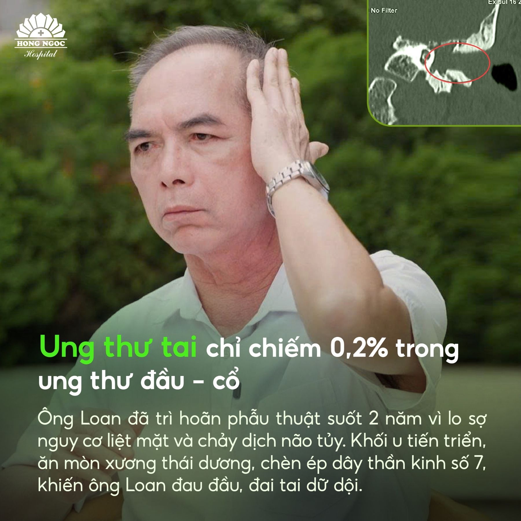 Ung Thu Tai Hiem 0