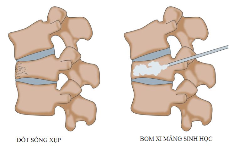 Huyết Áp Là Gì? - Sinh Học 11