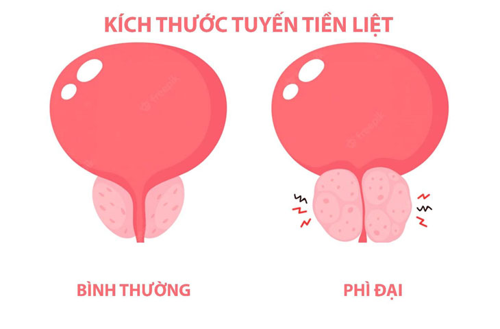 4. Can Thiệp Phẫu Thuật và Các Thủ Thuật Xâm Lấn