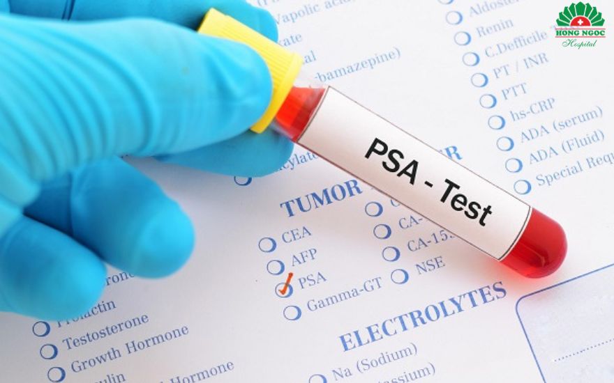 ung thư tuyến tiền liệt có chữa được không? cách kiểm tra?