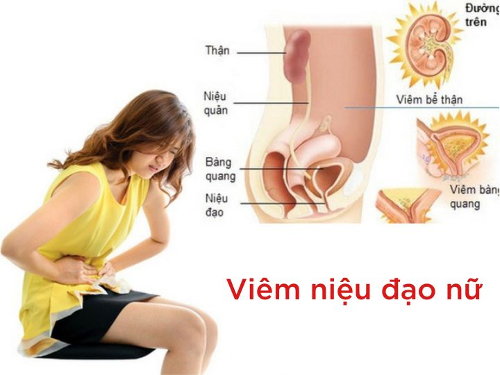 7. Phòng Ngừa Viêm Niệu Đạo Hiệu Quả