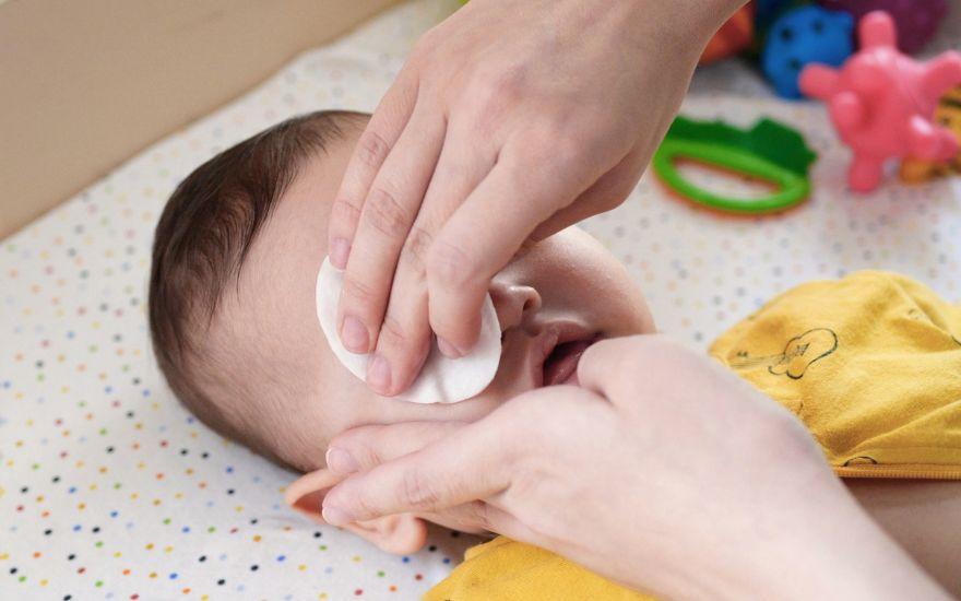 Vệ sinh mắt cho trẻ sơ sinh đúng cách giúp loại bỏ tình trạng đổ ghèn sinh lý sau khi sinh.