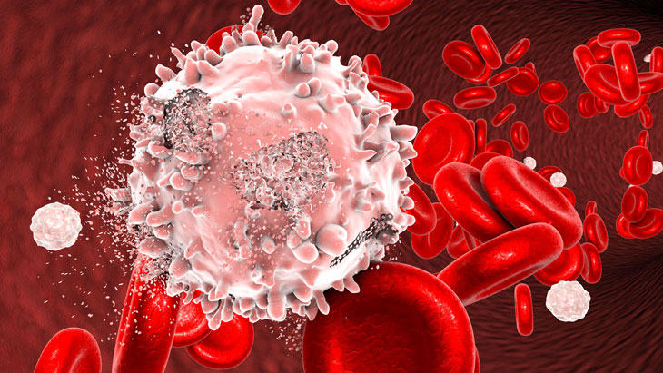 Triệu chứng và cách điều trị bệnh hồng cầu giảm bạch cầu tăng bạn cần biết