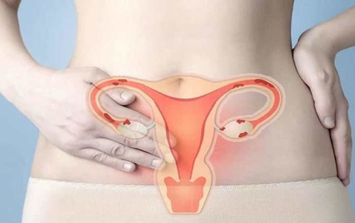 Các bất thường về tử cung có thể ảnh hưởng đến khả năng mang thai của bạn. Nhưng đừng lo lắng, việc phát hiện sớm qua bác sĩ khám tử cung và siêu âm sẽ giúp bạn có cơ hội mang thai và mang thai một cách an toàn. Hãy đến FPT Long Châu để được tư vấn và chăm sóc sức khỏe.