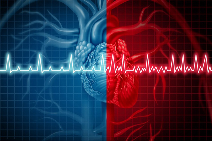 Bệnh tim đập nhanh - Nguyên nhân và cách khắc phục
